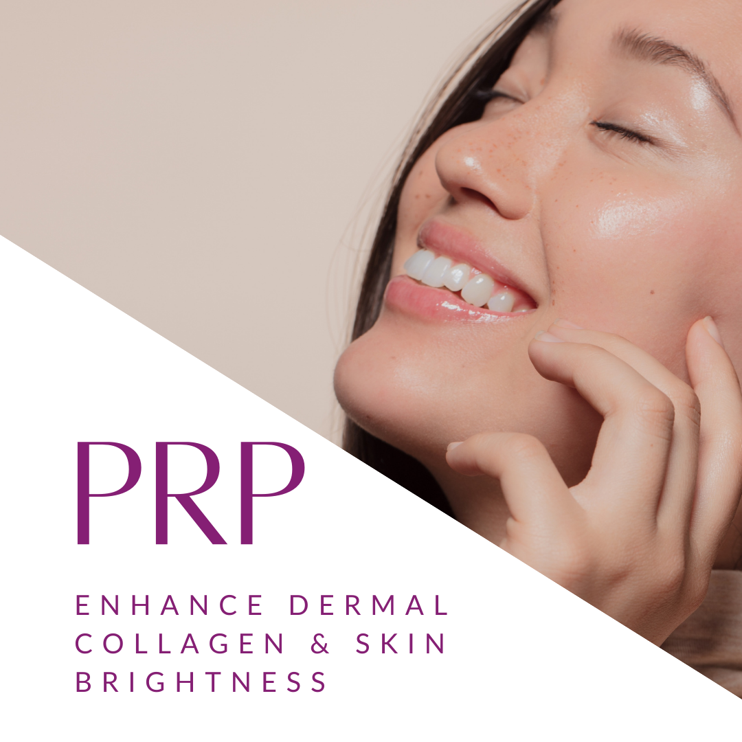 Microneedling with PRP Add On (Vampire Facial) - 1 Session