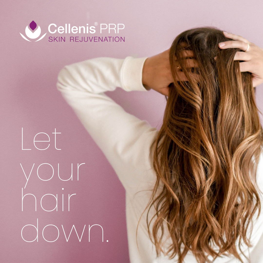 PRP Hair Restoration Treatment