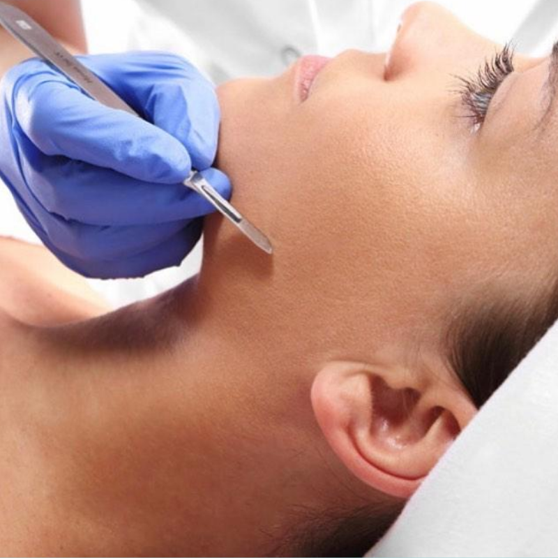 Dermaplaning Facial