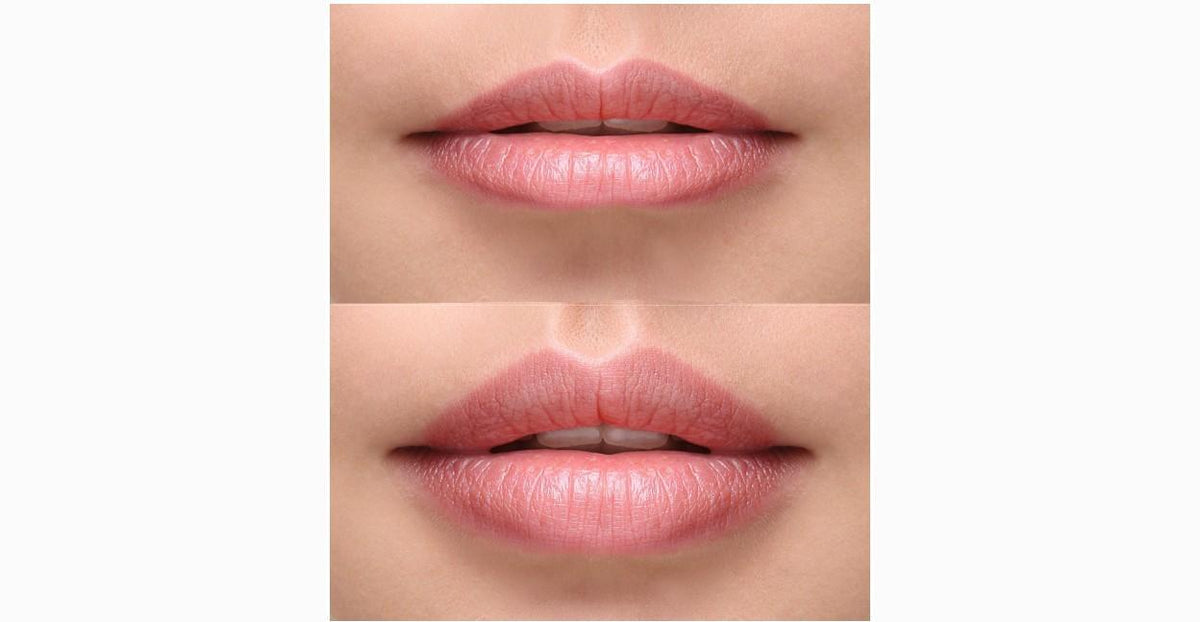 Lip Flip
