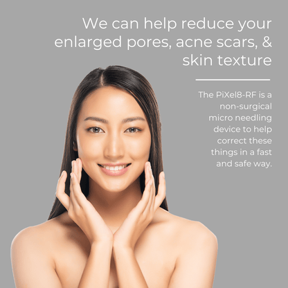 Pixel8 RF Microneeling Packages for Face Only  - Buy 2 Get 1 Free