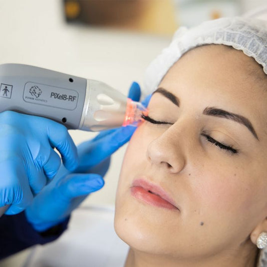 Day 4 Skintastic Savings -  Buy 1 RF Microneedling Treatment for Face and Receive 50% OFF A Second Treatment
