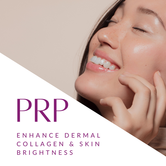 Microneedling with PRP Add On (Vampire Facial) - 1 Session