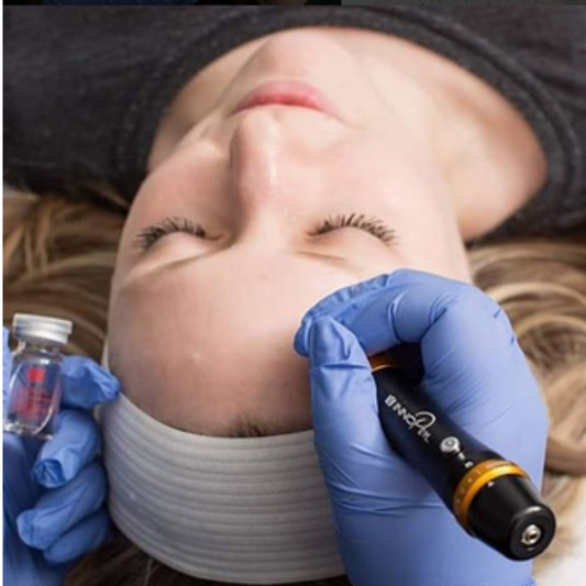 Microneedling Facial - Quantity 1