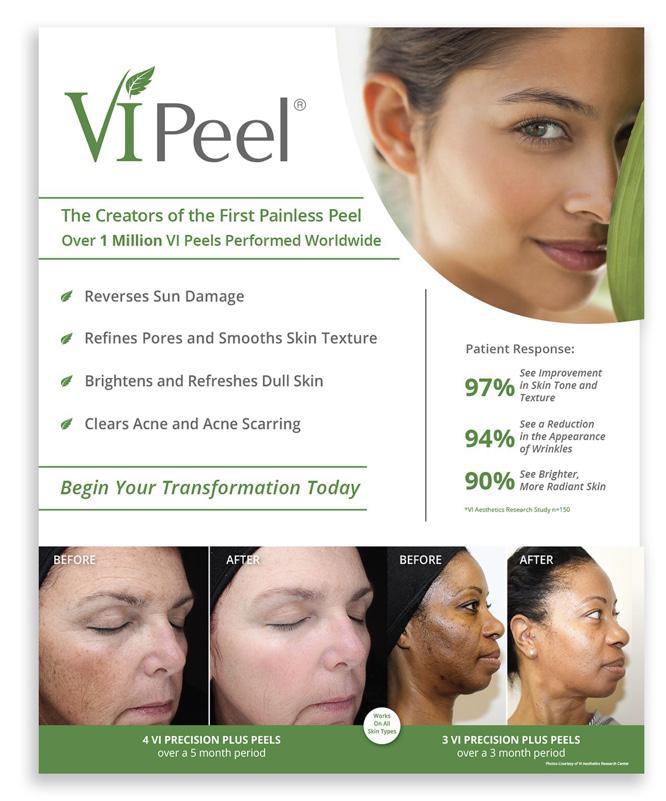 VI Peel - Package of 3