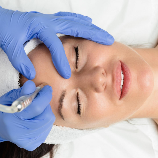 Diamond Microdermabrasion